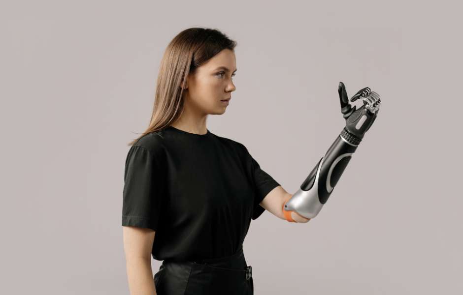 3d printed prosthetics